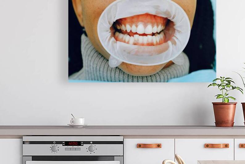 Healthy Gums by Dr Richard Halpern Orthodontist Calgary