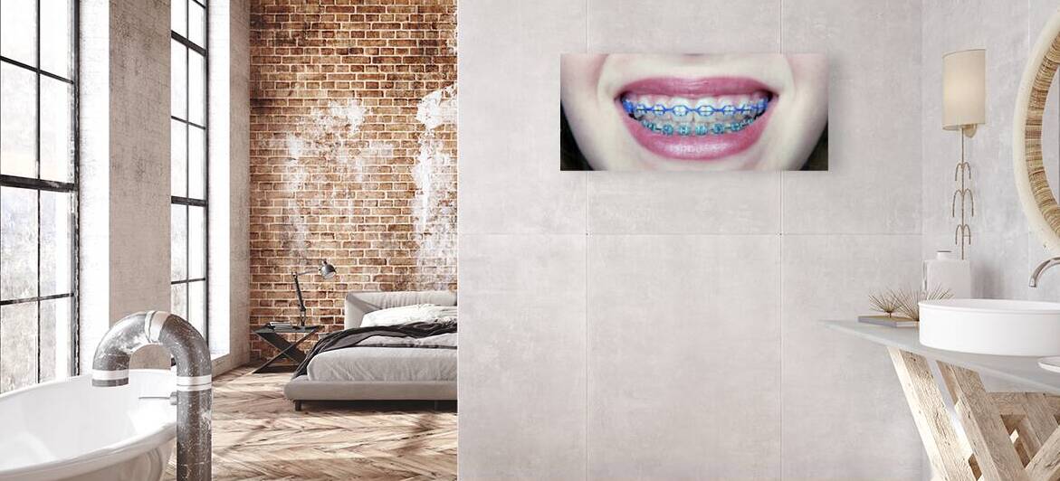 Braces by Dr Richard Halpern Orthodontist Calgary