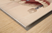 Dental bridge and crown placement over implants Wood print